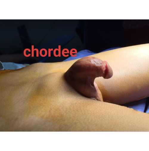 👶 A Case Of Pediatric Urologist
